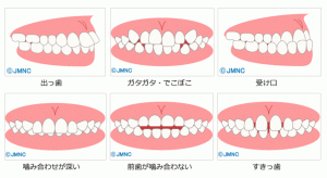teeth_dentition_main01
